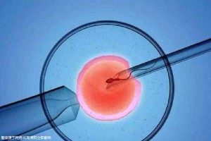 人工同志借卵代怀服务怎么找